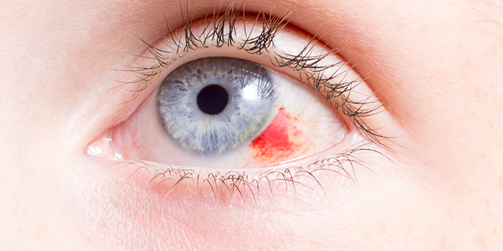 When to Call ForSight: Emergency Eye Care in Savannah, GA